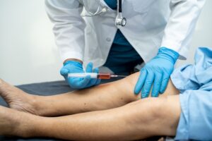 Stem Cell Therapy for Knee Pain