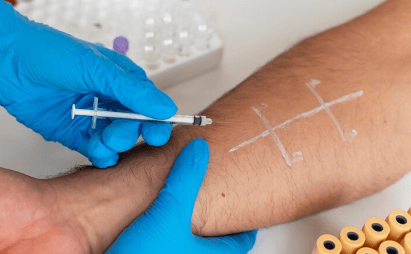 Lipid Profile Test