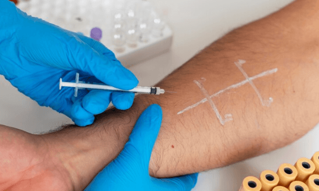 Lipid Profile Test